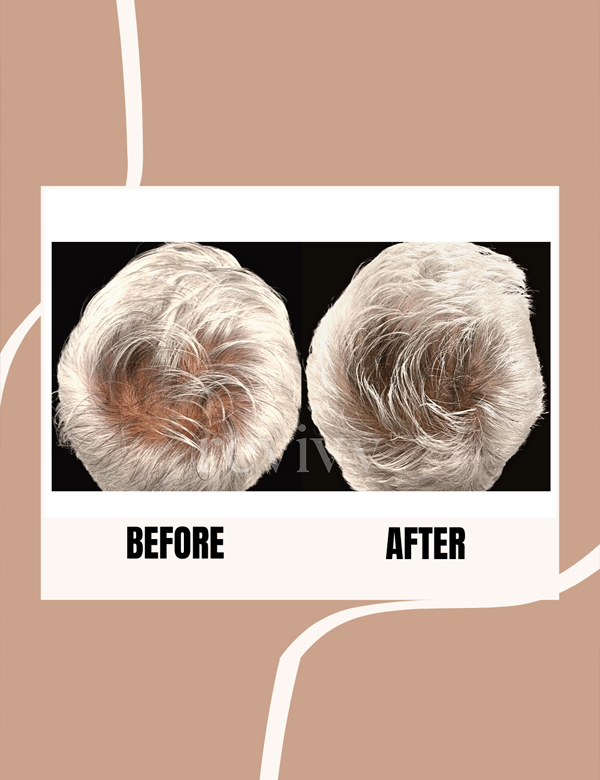 After using Revivv® for 8 months