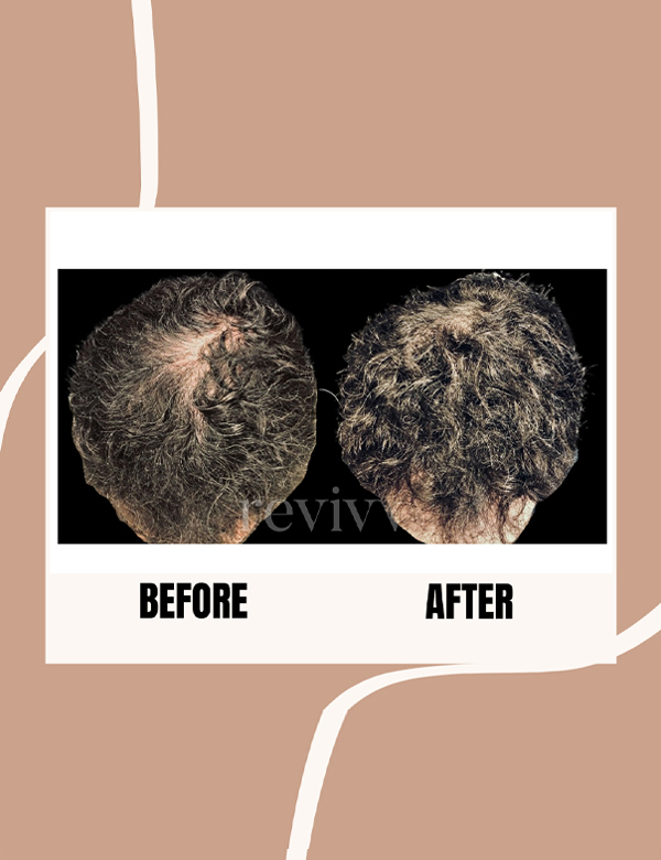 revivv for him before and after