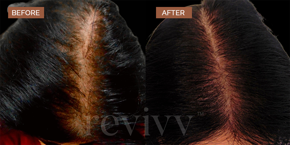 before&after