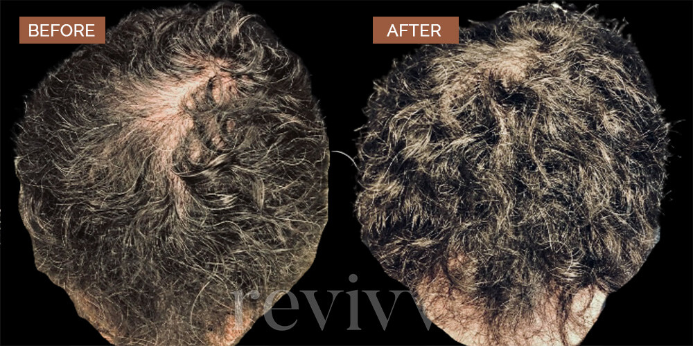 men-before-after-1