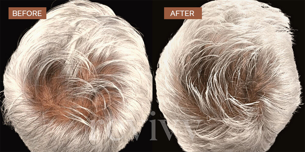 men-before-after-2